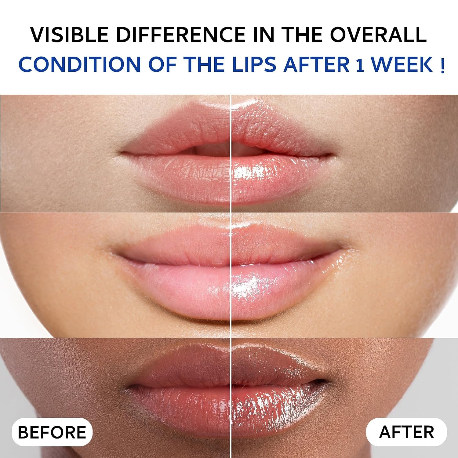 Lip Sleeping Mask (20G), Collagen Lip Mask Overnight, Lip Plumper with Hyaluronic Acid, Peptide Complex Lip Balm for Lip Wrinkle Repair and Plumping, Natural Hydration for Smooth Lips