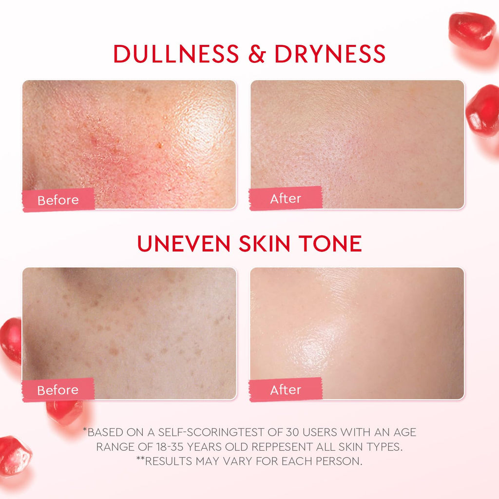 Face Moisturizer, Brightening Facial Moisturizer with 5% Niacinamide, Pomegranate Gel Cream for Uneven Skin Tone, Calming Allantoin for Sensitive Skin, All Skin Types, 100G