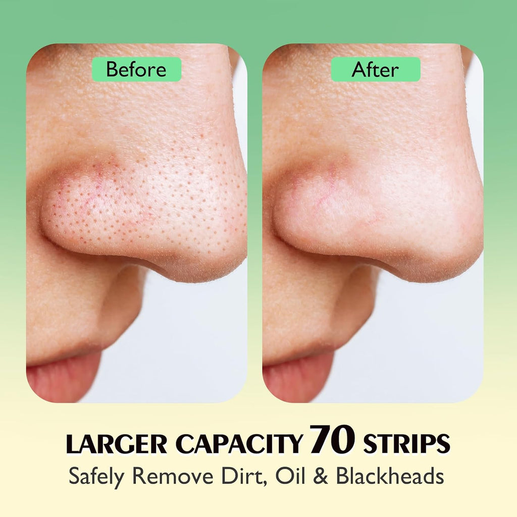 Blackhead Pore Strips,(70 Counts) Blackhead Remover-Deep Cleansing Nose Strips with Instant Pore Unclogging, Nose Plant Strips for Blackheads