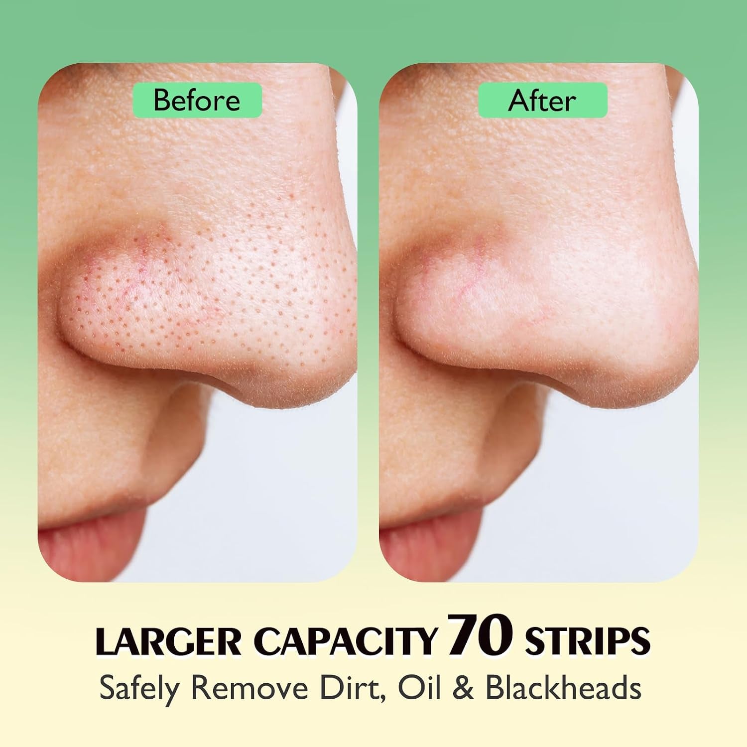 Blackhead Pore Strips,(70 Counts) Blackhead Remover-Deep Cleansing Nose Strips with Instant Pore Unclogging, Nose Plant Strips for Blackheads