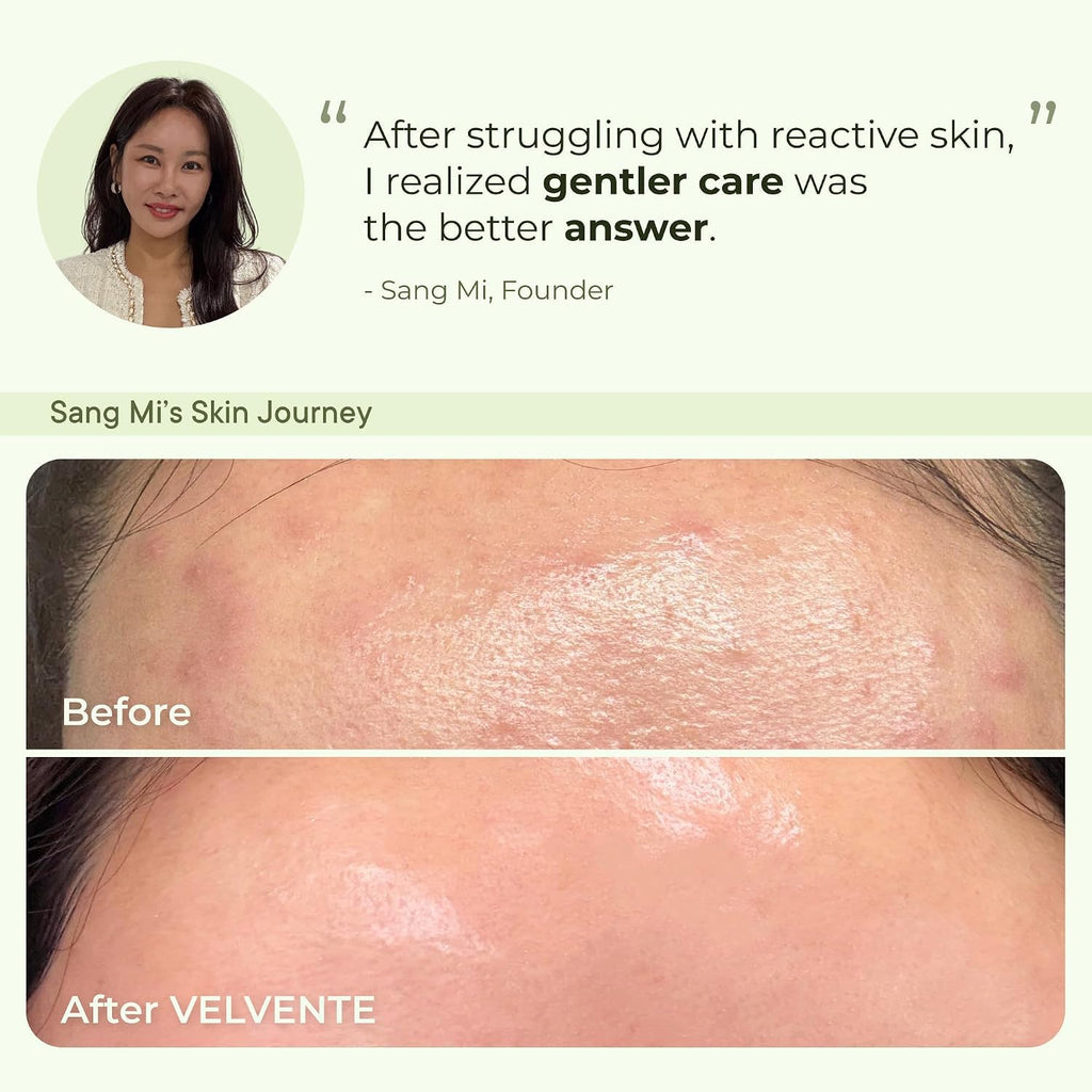 Matcha PDRN Korean Toner Pads, Dark Spots, Pores & Redness, Vegan | Gentle Exfoliation, Smoothing, Hydrating & Even Tone. AM&PM Acne-Prone Sensitive Skin 100Ct