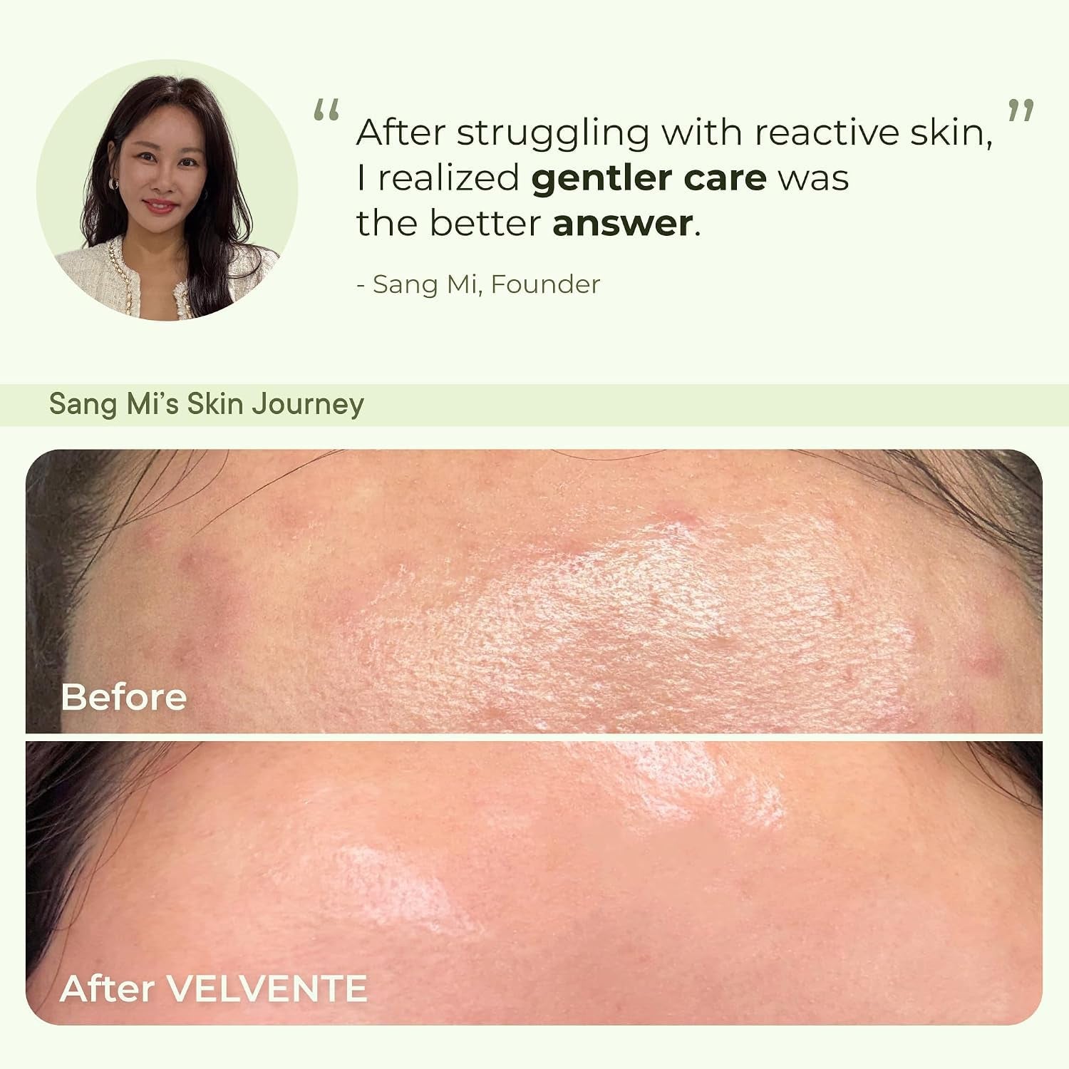 Matcha PDRN Korean Toner Pads, Dark Spots, Pores & Redness, Vegan | Gentle Exfoliation, Smoothing, Hydrating & Even Tone. AM&PM Acne-Prone Sensitive Skin 100Ct
