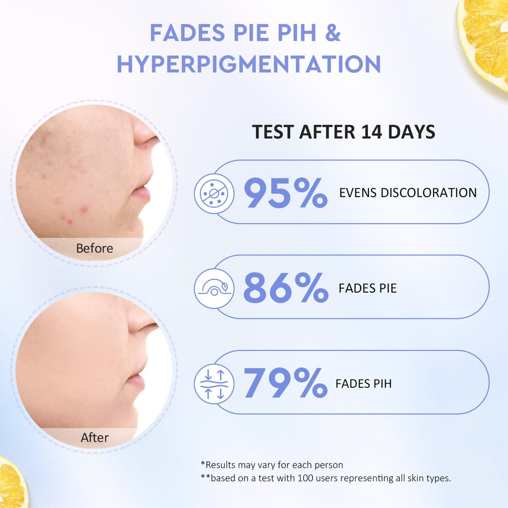 Brightening Face Moisturizer, Facial Dark Spot Moisturizer with Yuja Symwhite 377, Hydrating Gel Cream for Uneven Skin Tone, Calming Panthenol for Sensitive Skin, All Skin Types, 100G