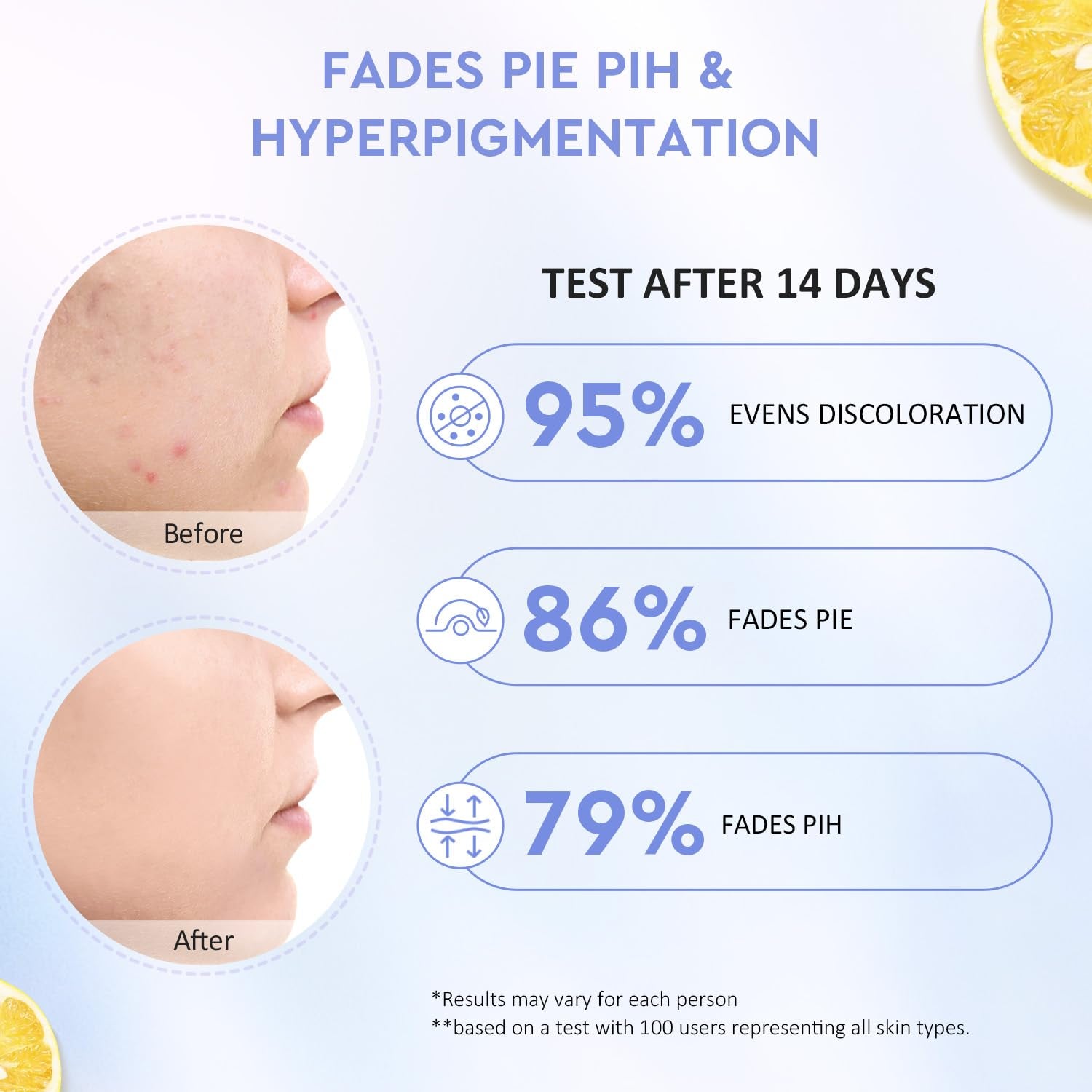 Brightening Face Moisturizer, Facial Dark Spot Moisturizer with Yuja Symwhite 377, Hydrating Gel Cream for Uneven Skin Tone, Calming Panthenol for Sensitive Skin, All Skin Types, 100G