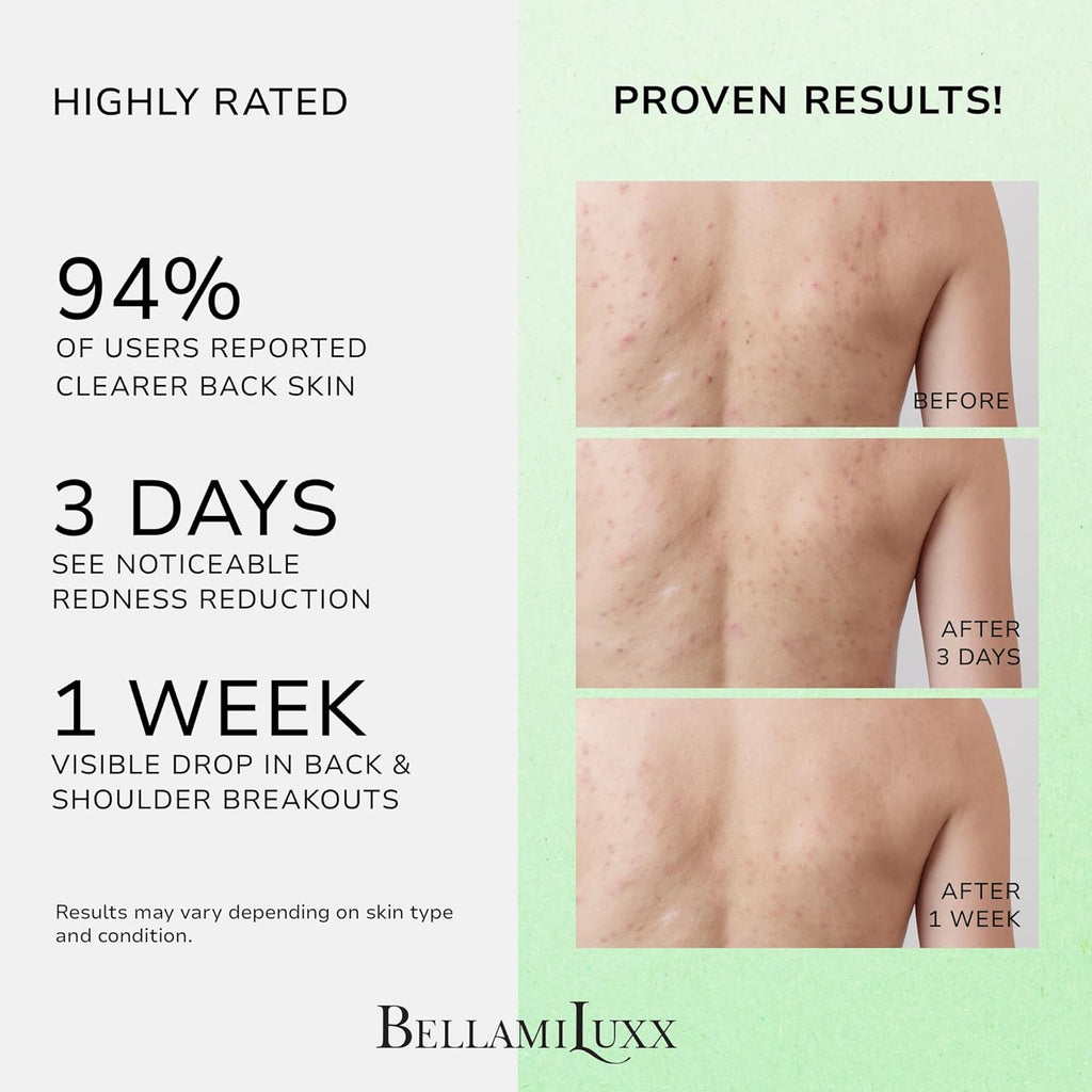 Back & Body Acne Treatment: 2% Salicylic Acid Back Acne Spray for Clear, Soothe & Moisturize - Effective Bacne Treatment with Tea Tree Oil, Body Acne Spray for Men, Women & Teens