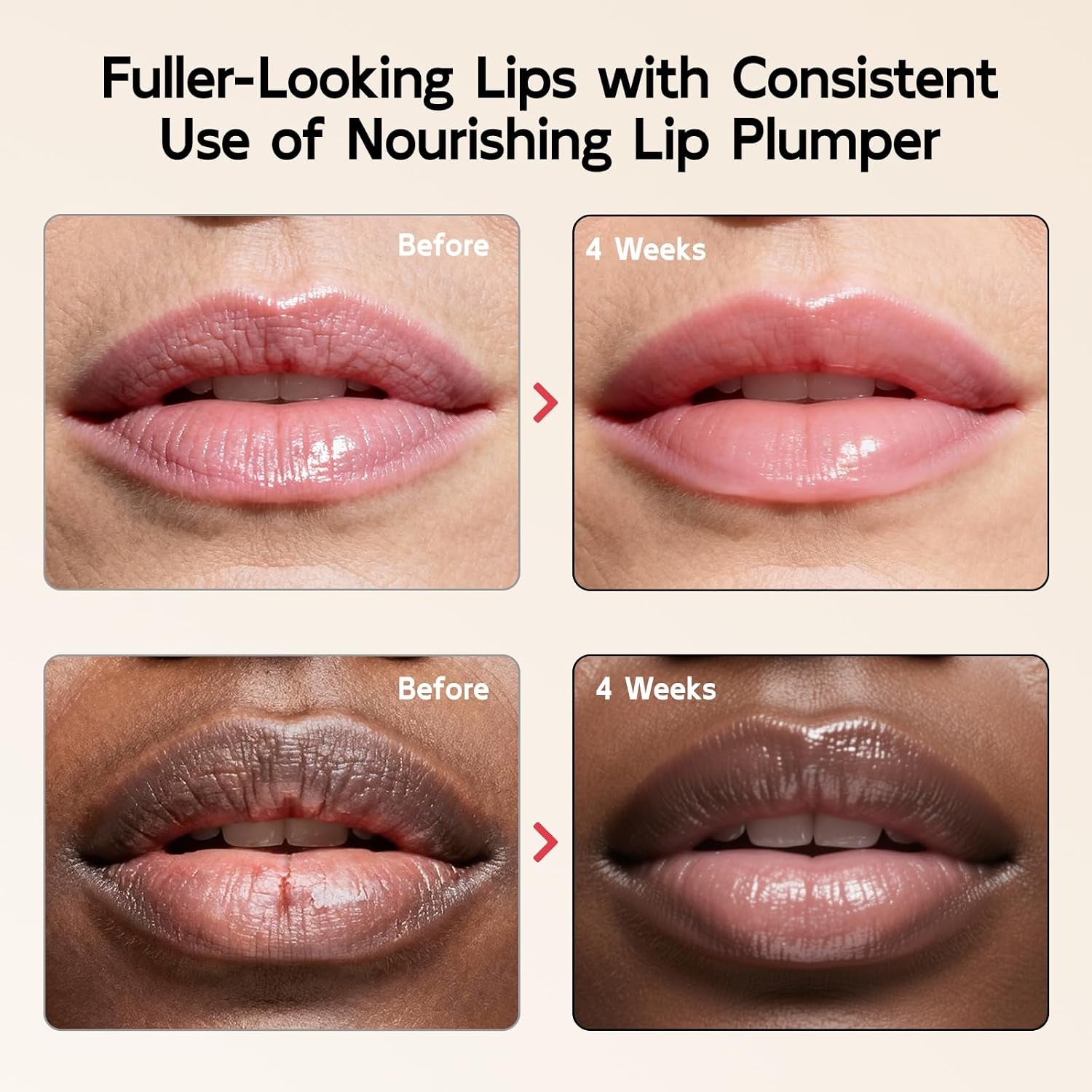 5% Volufiline Lip Serum & Gloss Hydrating Lip Care | Hydrating Lip Care with Shea Butter, Collagen, Peptide & PDRN, No Burning or Tingling, 0.35 Ounce, Clear