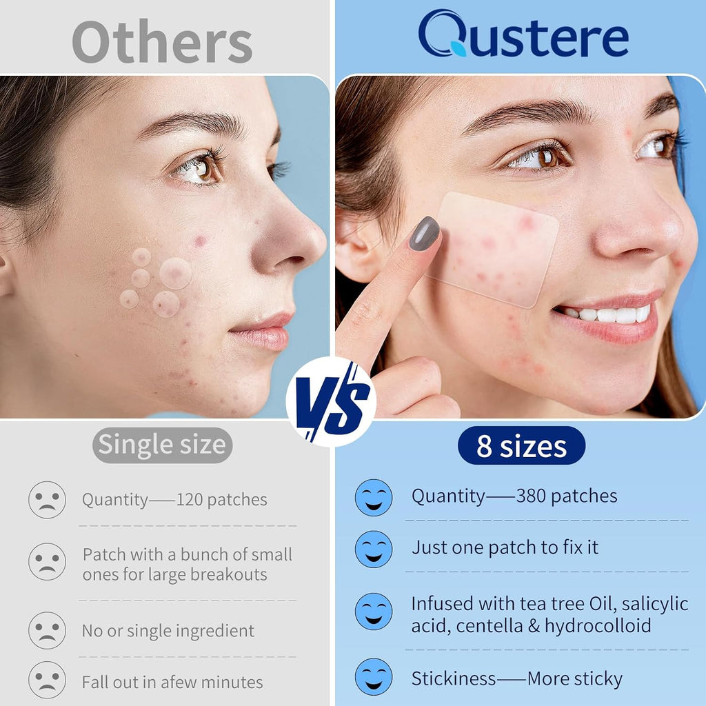 Large Pimple Patches for Face, Hydrocolloid Acne Patches, Big Hydrocolloid Bandages, Variety Shapes Zit Covers, Stickers with Tea Tree, Salicylic Acid & Cica Oil |8 Sizes |380 Count