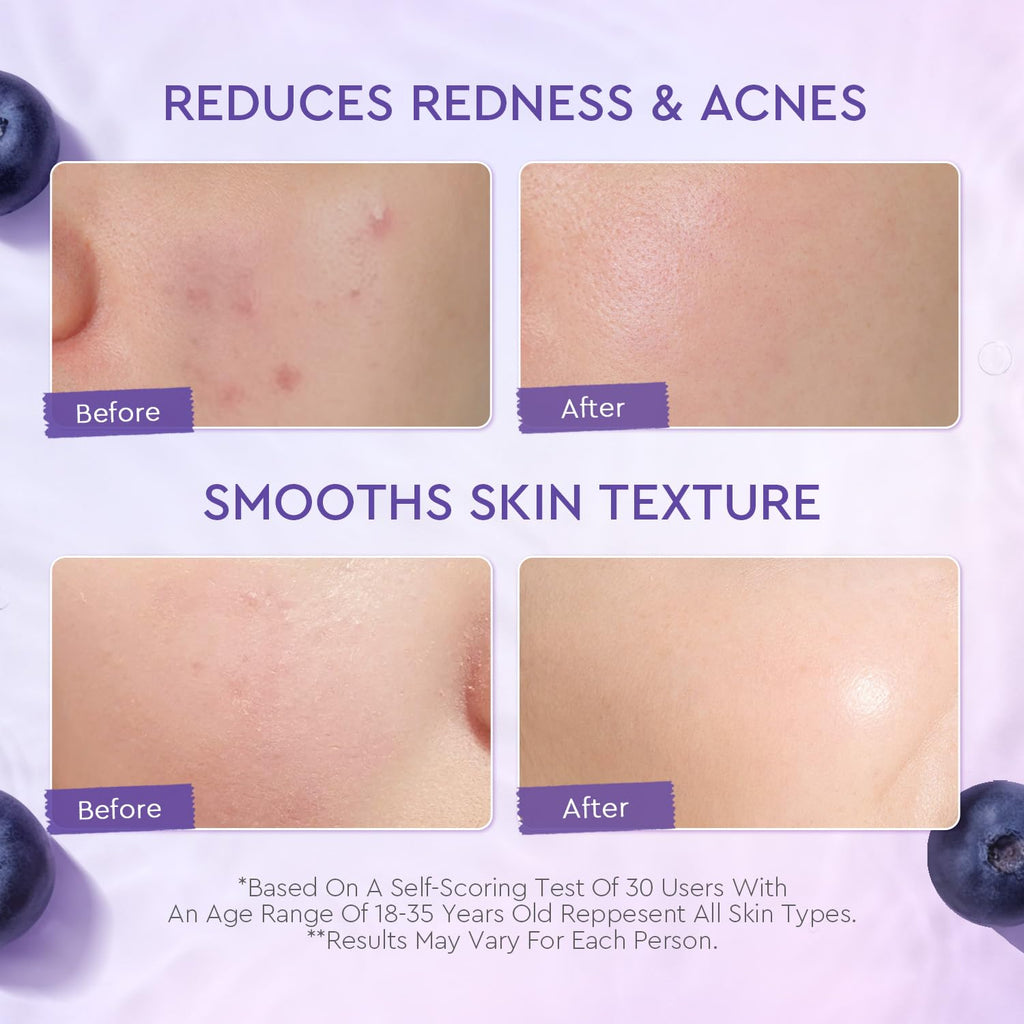 Blueberry Ceramide Face Moisturizer, Barrier Cream for Dry, Sensitive & Redness-Prone Skin, Strengthen Skin Barrier, Calm Irritation, Deep Hydration - 5X Ceramides, Blueberry, 100G