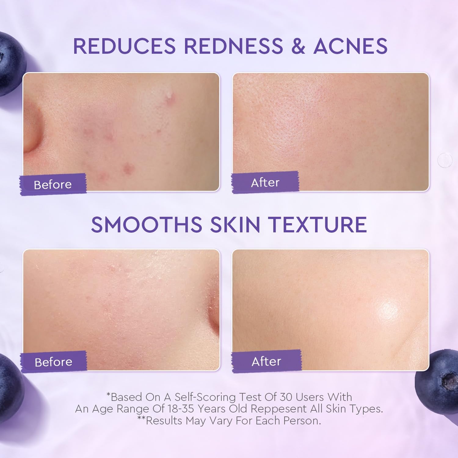 Blueberry Ceramide Face Moisturizer, Barrier Cream for Dry, Sensitive & Redness-Prone Skin, Strengthen Skin Barrier, Calm Irritation, Deep Hydration - 5X Ceramides, Blueberry, 100G