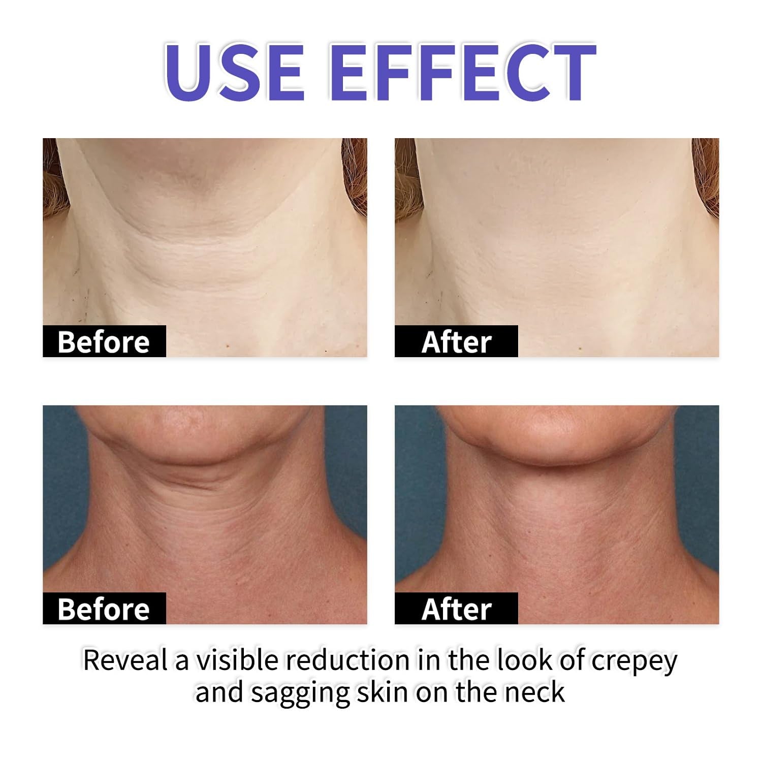Tighten and Lift Neck Firming Cream, Neck Creams for Tightening & Lifting Sagging Skin & Hydrating, Help Reduce Fine Lines & Wrinkles